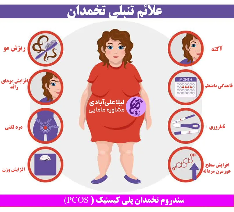 آیا تنبلی تخمدان درمان دارد؟