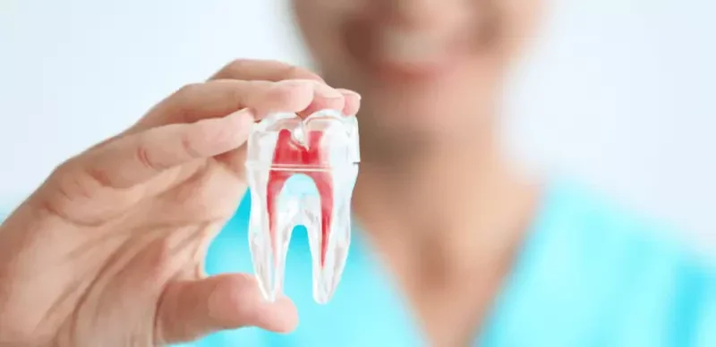 انواع درمان ریشه دندان یا عصب کشی چیست؟