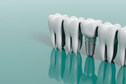 مراقبت های بعد از ایمپلنت دندان