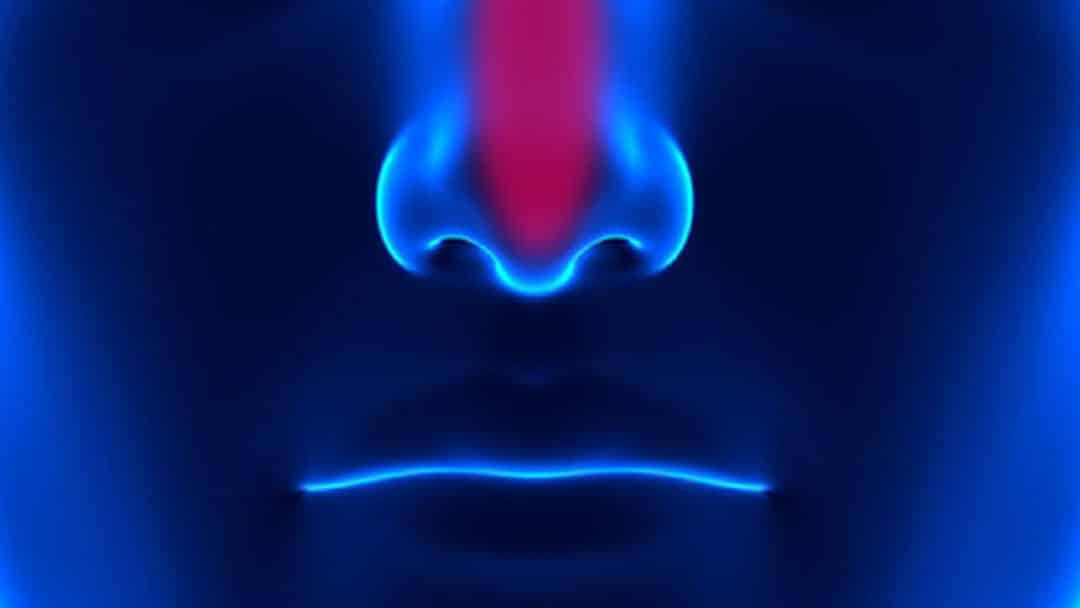 نازوفارنکس چیست؟