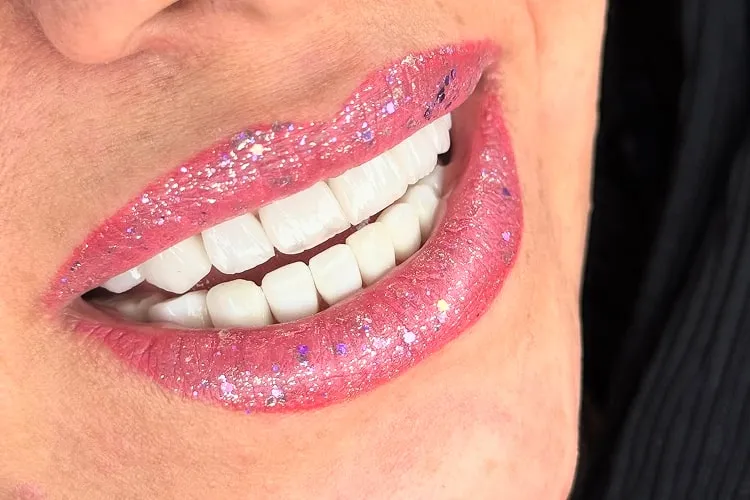 درد لمینت؛ واقعیتی که باید بدانید!