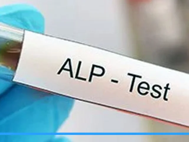 آیا آسیب کبدی با آزمایش ALP مشخص می‌شود؟