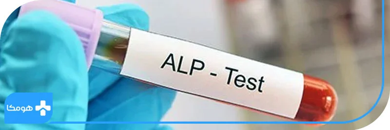 آیا آسیب کبدی با آزمایش ALP مشخص می‌شود؟