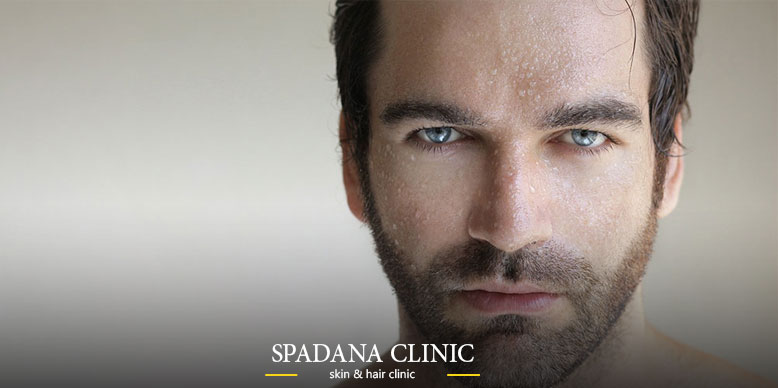 آشنایی با روش‌های پاکسازی پوست